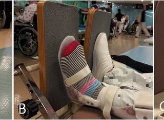 기립 훈련용 틸트 테이블