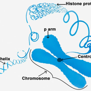 프리드리히 운동실조증