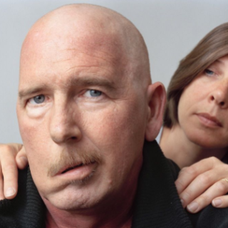 얼굴 마비, 안면 마비