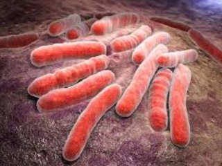 잠복결핵 진단 및 치료 방법 : latent tuberculosis, LTB 1