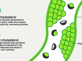 콜레스테롤 종류와 콜레스테롤 낮추는 방법 22