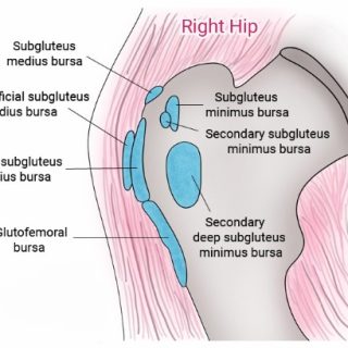 대전자 점액낭염은 엉덩관절 바깥쪽 통증의 원인? 8