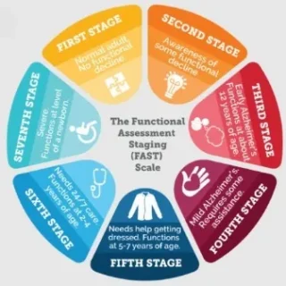 알츠하이머병의 7단계