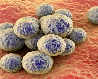 MRSA 감염 증상 및 치료 : 메티실린내성 황색포도상구균 1