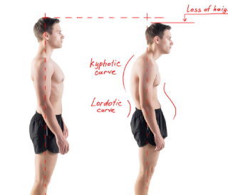 나쁜 자세를 바꾸는 운동방법 : Good Posture 12