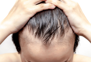 탈모에 양파 주스 도움이 된다고? 1