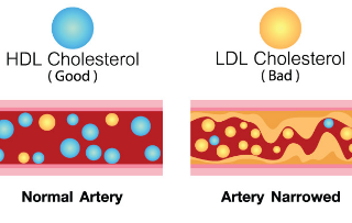 나쁜 콜레스테롤(LDL) 자연스럽게 낮추는 방법, Cholesterol 15