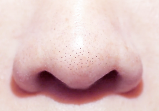 안전하게 블랙헤드 제거하는 방법 27