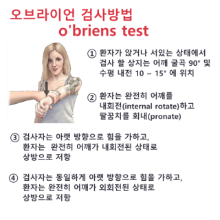 오브라이언 테스트 : O'Briens Test, 관절와순 병변 78