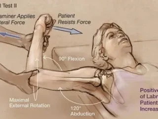 이두근 부하검사, Biceps Load II Test : SLAP 병변 감지 검사 16