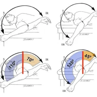 어깨내회전결핍(GIRD) 이란?, Glenohumeral internal rotation deficit 1