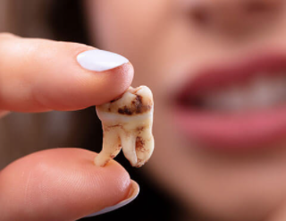 치아에 안좋은 음식, 무엇? 1