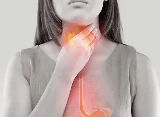 역류성 식도염 치료 음식에 강황? 28