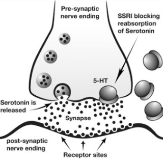 선택적 세로토닌 재흡수 억제제 효과 : 우울증 50