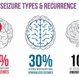 부분 발작 증상과 유형 : 근육 수축, 시각 장애, 실신 1