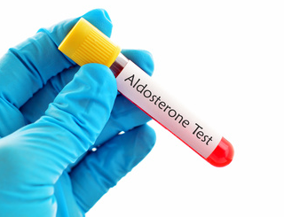 알도스테론 검사 방법 : 전해질과 체액 이상 13