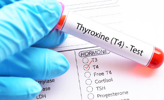 T4 검사 : 티록신 호르몬 검사 9