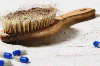 비오틴 모발건강 효과 있나요? 50