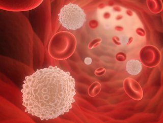 과다점성증후군 : 혈액의 점도가 증가↑혈류 감소↓ 1