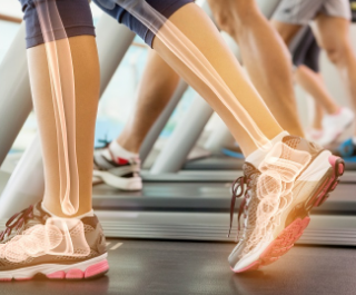 뼈 건강에 좋은 음식과 영양소 7