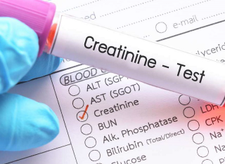 크레아티닌 혈액검사 : 신장 기능 검사 35