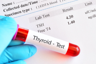 갑상선자극호르몬 검사 : 갑상선기능저하/항진 검사 1