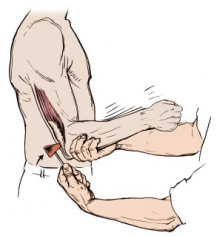 C7 신경근 평가 방법 : 상완삼두근, 손목굴곡근, 손가락신전근 1