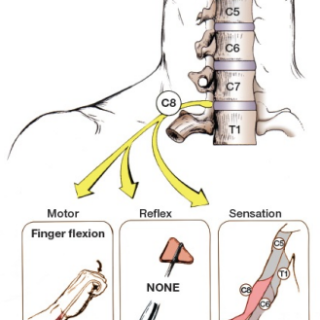 C8 신경근 평가 방법 : 천지굴근, 심지굴근, 충양근 24