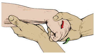 C7 신경근 평가 방법 : 상완삼두근, 손목굴곡근, 손가락신전근 17 C7 신경근 평가 방법 : 상완삼두근, 손목굴곡근, 손가락신전근 16