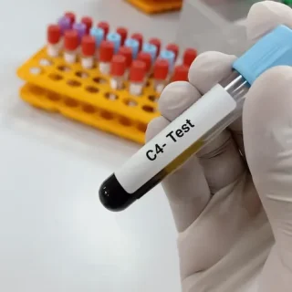 보체 검사 : 항체의 감염 투쟁에 도움되는 단백질 검사 1