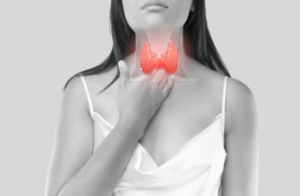 요오드 결핍 : 목이 붓고,체중 증가