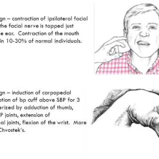 저칼슘혈증, 칼슘결핍증