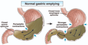 정상적인 위배출
