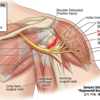 액와신경(Axillary nerve, 겨드랑신경)