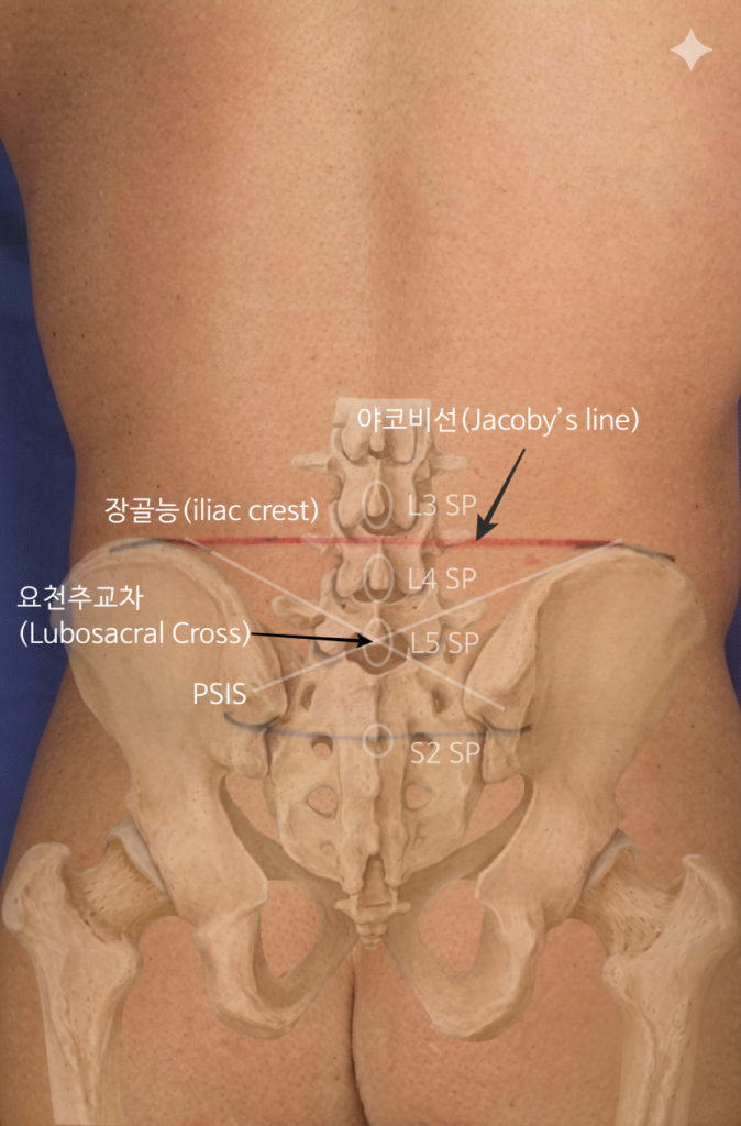 요추5번 촉진방법