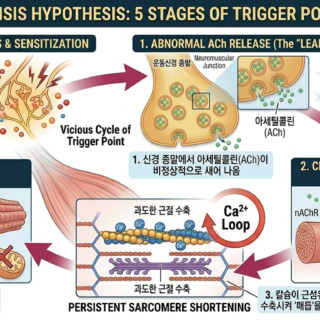 에너지 위기 가설 5단계 : 아세틸콜린-칼슘 농도-국소허혈-ATP고갈